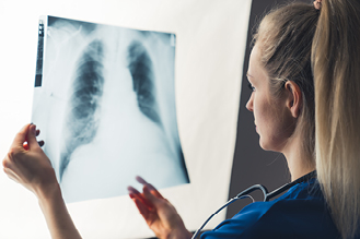 a nurse examines an xray photograph of human lungs